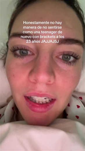 They’re honestly cute tho #braces | brackets