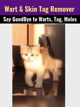 WART REMOVAL FOR ALL TYPES OF TAGS