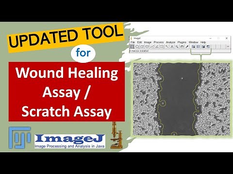 Updated tool: Wound Healing Assay | Scratch Assay | Cell Migration Assay