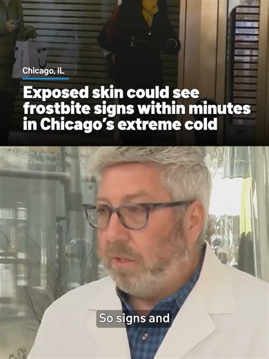 Winter Precautions Against Frostbite in Chicago