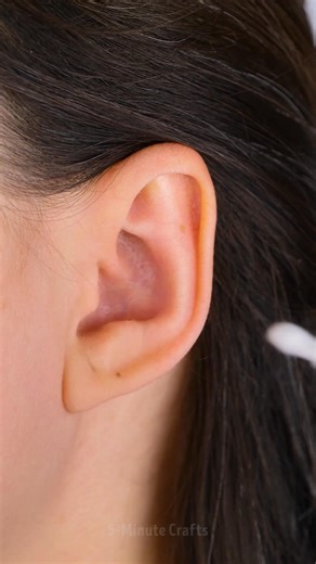 The easiest first aid hacks 🌸 | 5-Minute Crafts GIRLY