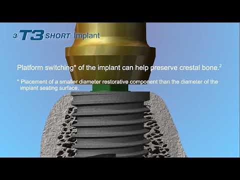 Biomet 3i T3 Short Implant