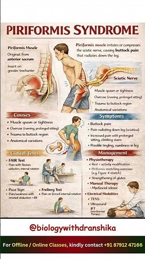 Piriformis Syndrome: When a small muscle causes big pain. #piriformissyndrome #sciaticpain #neet