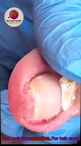 Daily Nail Care Habits for Cracked Toenails Using Safe At-Home Techniques #ToenailRoutine #HealthyNails #CleanNailsDaily #NailCareTips | Bye