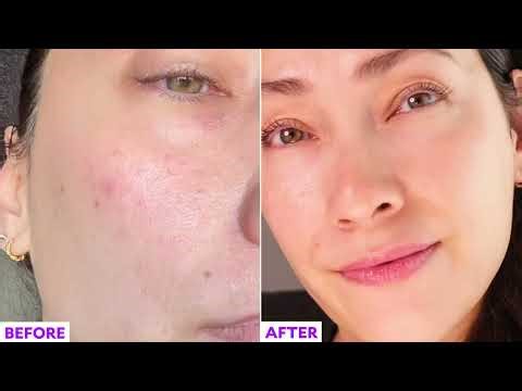 Get the Most from Your Vitamin C Serum | Fièra
