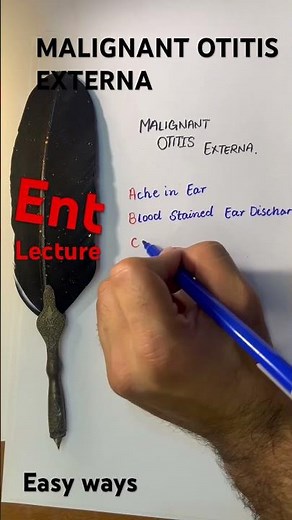 Malignant otitis externa#otitismedia#otitis