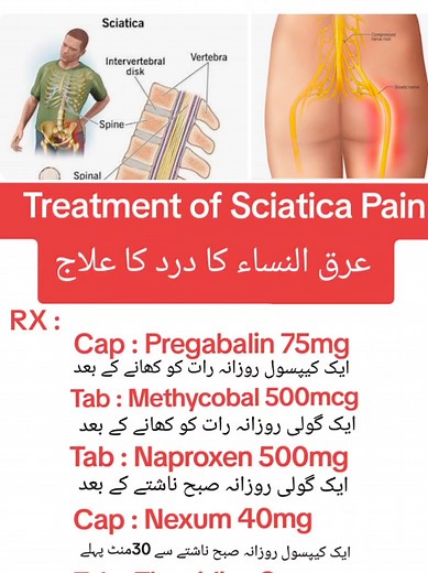 Understanding Sciatica: Causes, Management, and Relief