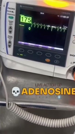 Adenosine used to diagnose and treat certain types of abnormal heart rhythms (arrhythmias) .