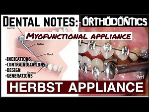 HERBST APPLIANCE II DESIGN II GENERATIONS II MYOFUNCTIONAL APPLIANCE II ORTHODONTICS