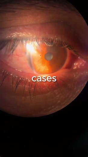 Why do they remove metal from the skin with a magnet?🤔