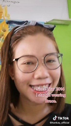 8 Years of Wearing Braces: A Journey to Brace Removal