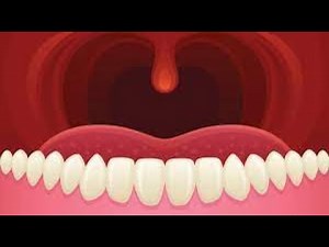 The Unsung Hero: Unveiling the Purpose of Your Uvula