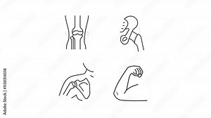 Joints illness animation set. Human body animated line icons. Clinical treatment, x ray. Dislocation, rheumatism. Black illustrations on white background. HD video with alpha channel. Motion graphic