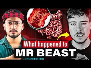 A Rare Disease that MrBeast is Suffering From😱
