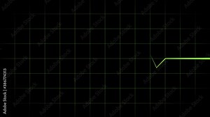 Human Circulatory System Heart Anatomy Animation Concept. Human Circulatory System Heart Beat Anatomy Animation Concept. Human Circulatory System. Medically accurate animation of Heart - Human heart