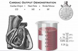 Understanding the concept of ...... Cardiac Output = Stroke Volume X Heart Rate | Dr Saleem Abbas