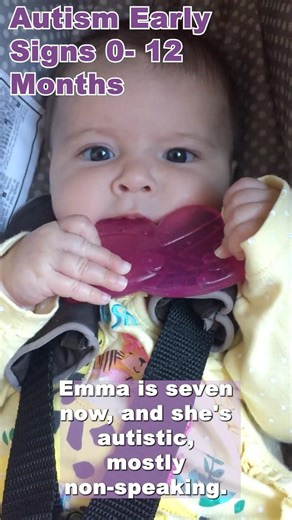 Part 1: Early Autism Signs We Missed as Parents 💛 #autism | Autism in Baby under 1