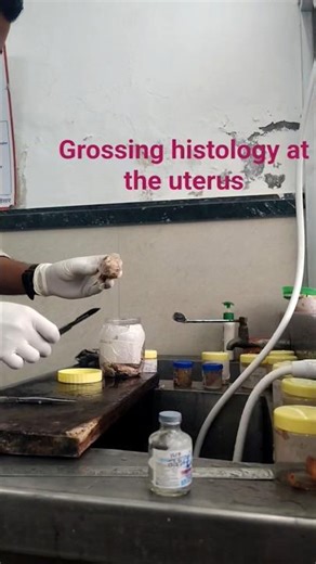 grossing histology at the uterus #allstudents ‪@tseries‬ ‪@apex.soft.tissue‬