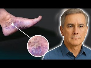 SENIOR? 15 HIDDEN Neuropathy, Fibromyalgia And Sjogren's SIGNS Starting in Your TOES You Might MISS