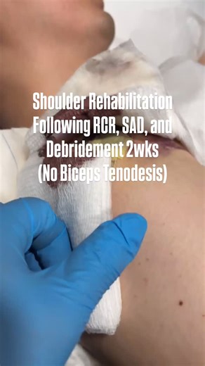 Bridge Rehab & Pain Clinic on Instagram: "🖐️ Shoulder Surgery & Rehabilitation (Rotator Cuff Repair / Subacromial Decompression, Debridement) Among patients who have undergone shoulder surgery, many begin rehabilitation without fully understanding what was done during surgery or what the recovery process truly involves. A common question we hear is: “People around me felt better in just 2 weeks—why am I still uncomfortable at 6 or 8 weeks?” Without a clear understanding of the type of shoulder 