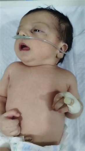Febrile Seizure in Newborn Baby | NICU Emergency Care