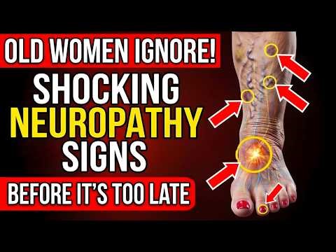 WOMEN OVER 60: 14 Early Neuropathy Signs in Your Feet (Most Ignore #4)