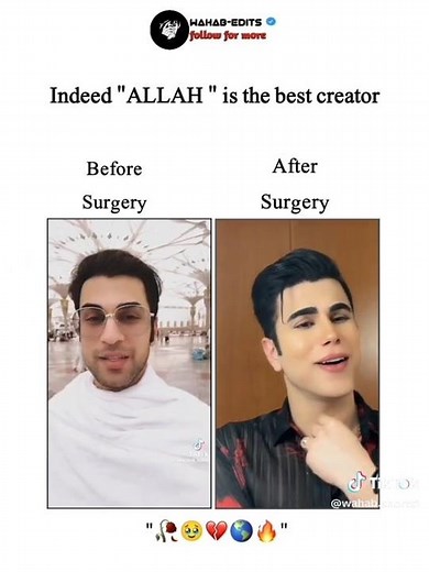 Ken doll before and after surgery