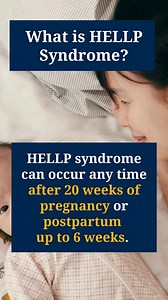 #HELLP syndrome is a life-threatening #pregnancy complication, considered a severe variant of #preeclampsia. H (hemolysis-breaking down of red blood cells) EL (elevated liver enzymes) LP (low platelets) HELLP syndrome can occur any time after 20 weeks of pregnancy or postpartum up to 6 weeks. HELLP syndrome can be difficult to diagnose, because all of the typical signs of preeclampsia may not be apparent, such as high blood pressure and protein in the urine. Its symptoms are sometimes mistaken f