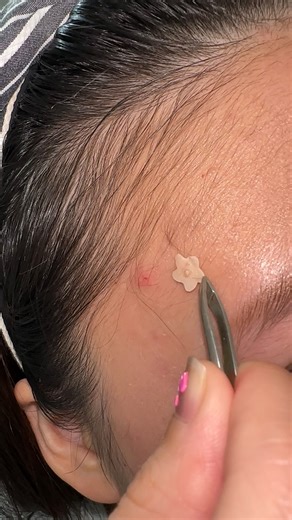 Dododots Beauty Patch | Pimple Patch | Cute Acne Patch on Instagram: "Our dots are as thin as this Instagram ratio (and they feel like nothing on skin too) P.S. The way we did this was by setting the dimensions 5120 x 1080 on Canva -> exported just one short video out with that dimension -> Uploaded the video onto CapCut and every other clip imported into the app could be adjusted to the same exact size -> Edit your video -> Export from CapCut and upload onto IG reels 🫶"