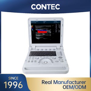 [Hot Item] Contec Cms1700b Portable Hospital Scanner Machine Color Doppler Ultrasound