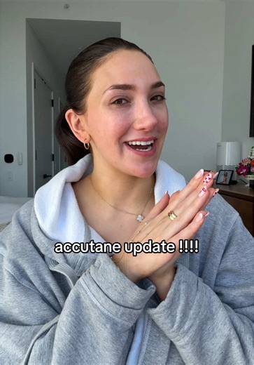 Accutane Journey: 4 Month Update on Skin Progress