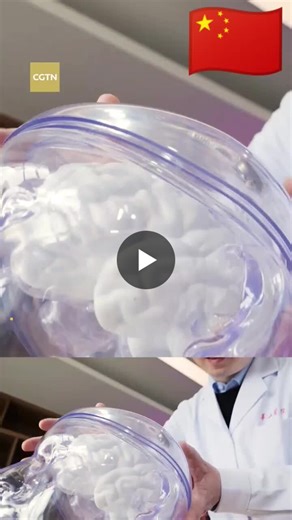 #coolchina #china #technology #nmpa #neuraclemedicaltechnologyshanghai #firstinvasivebraincomputerinterfacemedicaldevice #bci | Naveen K.