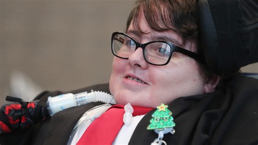 'You can do anything': Doctors said she wouldn't live a day. Now this UA grad is a lawyer