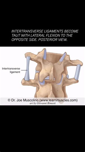 🔹 LearnMuscles.com 🔹 Excellence-in-education 🎁Holiday sale! 15% DISCOUNT FREE ebooks! Use code HOT15 (new subscribers only) ✨Intertransverse Ligaments of the Spine Intertransverse ligaments are oriented in the frontal plane, so they limit motion in the opposite direction, in other words, opposite-side lateral flexion (contralateral lateral flexion). In the illustration here, the left-side intertransverse ligament becomes taut with right-side lateral flexion, thereby limiting that motion. Note