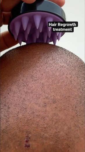 HairRegrowth Treatment the ordinary multi-Peptide serum for hair density