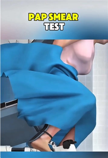 |Ever wondered why a Pap smear test is important for early cervical health screening?| #PapSmearTest #CervicalHealth #WomensHealth #PreventiveCare #EarlyDetection