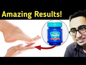 Rub VICKS VapoRub on Your Feet and Feel What Happens In Body - Pharmacist Javaid