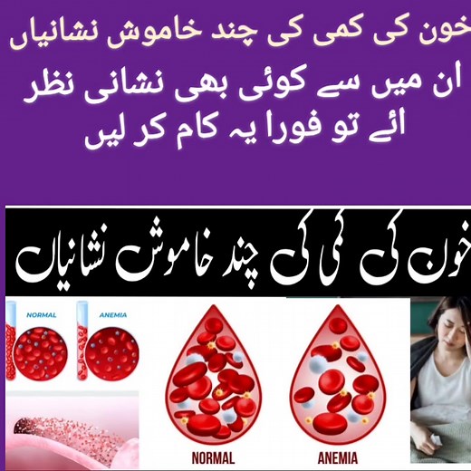 You may notice pale skin and cold hands and feet. Iron-deficiency anemia can also cause you to feel dizzy or lightheaded. Occasionally, it can cause chest pain, a fast heartbeat and shortness of breath. Iron deficiency can cause you to have unusual cravings for non-food items such as ice, dirt or paper. #foryou#trending#viral #foryou #ralshort #foryou #viralreels #trendingreels #fypシ゚viral #fypviral #foryoupage #viralshort #foryouシ | Dynamic Health with Dr. G.A