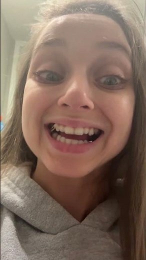 Shauna Rae: Invisalign Day 35