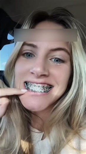 Secret to a Perfect Smile #shortsvideo