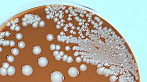 Bacillus cereus: La bacteria que puede intoxicarte cuando no conservas bien la comida