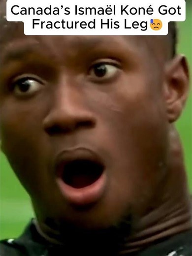 Canada’s Ismaël Koné Broken Leg Injury vs Qatar 😱 (World Cup 2026) #shorts #fifaworldcup