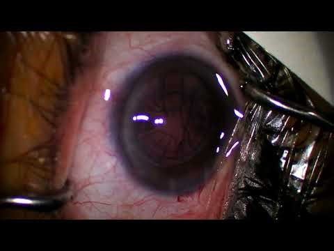 2025 12 09 143927 Panoptix pro