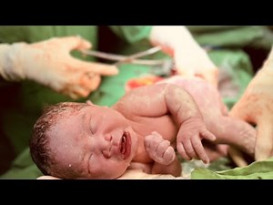 CS Delivery Operation at Ortigas Hospital and Health Care (April 17, 2024)