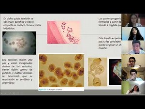 Hidatidosis Echinococcus granulosus