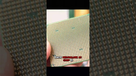 The Future of Brain Implants: Neuralink's Tiny Revolution