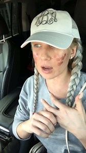 201K views · 322 reactions | Erbium day 6 update/ check up day ❤ | Bombshell Beauty Boutique with Kesha | Facebook