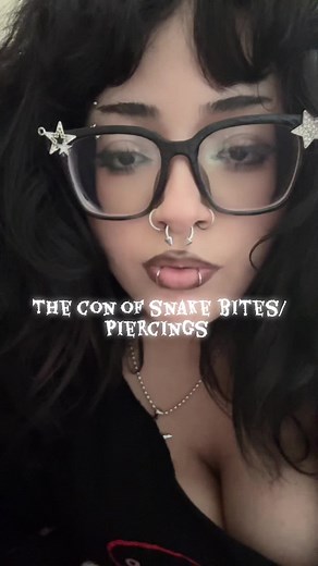 Loving My Snakebites: Planning for Angel Bites!