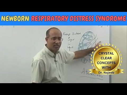Newborn Respiratory Distress Syndrome | Pathophysiology🫁