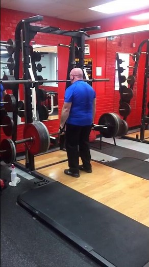 Lifting weights four months after Ream and Run Shoulder replacement (Dr. Carofino)